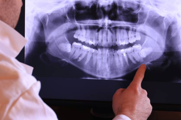 Best Emergency Tooth Extraction  in Walterboro, SC